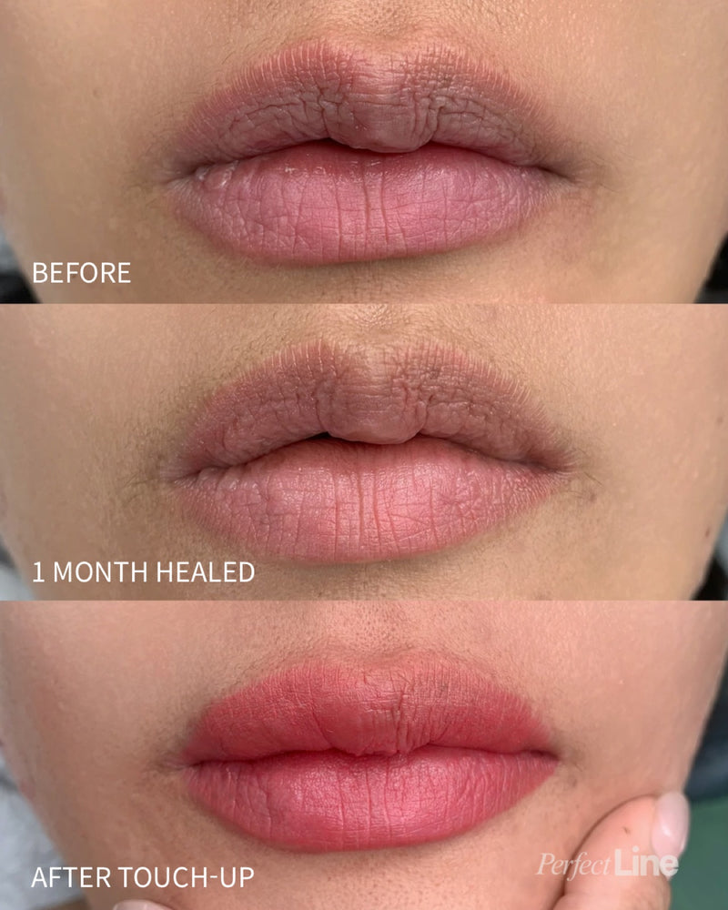 Dark lip neutralization lip blush: before, healed, and after touch-up — Perfect Line LA